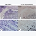 The microsporidian Enterocytozoon hepatopenaei is not the cause of white feces syndrome