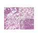 Determination of the infectious nature of the agent of acute hepatopancreatic necrosis
