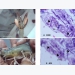 Pythium insidiosum - mầm bệnh nấm cơ hội trên tôm thẻ bố mẹ