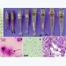 Phòng ngừa bệnh vi bào tử trùng (Microsporidian) gây bệnh EHP trên tôm